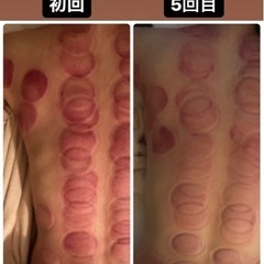 6月7月は新規の方PayPay決済で20%戻ってきます！新メニューホットストーンセラピー6600円！ - 練馬区
