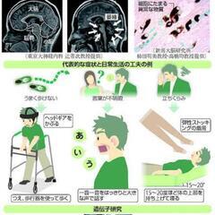 難病！多系統萎縮症 の治療法や治療出来る針灸や病院やリハビリなど...