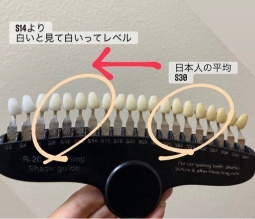 ホワイトニング体験