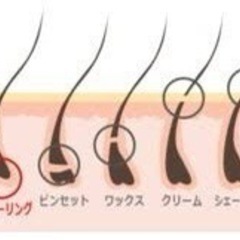 ブラジリアンワックス　シュガーリング脱毛 - 大田区