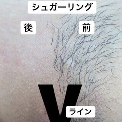ブラジリアンワックス　シュガーリング脱毛 - ボディケア