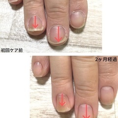 〈自爪育成〉モニター募集 