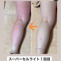 脚痩せしたい方必見の画像