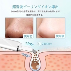 【新品】ウォーターピーリング 毛穴汚れの除去 フェイスクレンジング 黒ずみ 角質除去 超音波 イオン導入＆導出 美肌ケアの画像