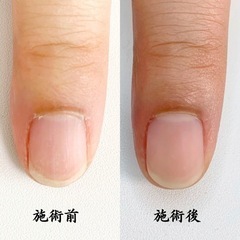 【締切間近】ネイルケア モデルさん募集します。