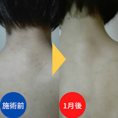 アトピー・アレルギーを自分で改善する幸せ整体教室の画像