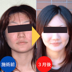 アトピー性皮膚炎を改善させるセラピスト養成講座の画像