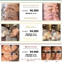 超•全身脱毛/¥3980円【プライベート空間エステサロン】の画像