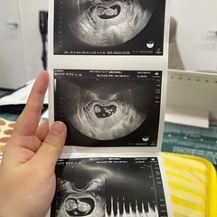 現在妊娠4ヶ月２０歳のままです！