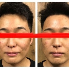 小顔になりたい人必見！男女🆗💖中野駅から徒歩5分の画像