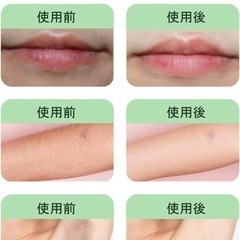 光脱毛器 IPL光 VIO対応 光エステ フラッシュ式 50万回照射 9段階調節 髭 顔 家庭用の画像