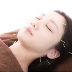 美容鍼　無料モニター体験　2名様限定
