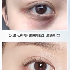 👁目の黒いクマ悩んでる方必見🔥 - ボディケア