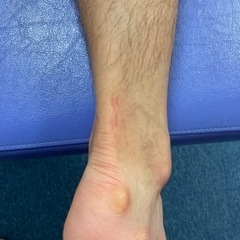 足元のトラブルある方募集致します。【モニター】