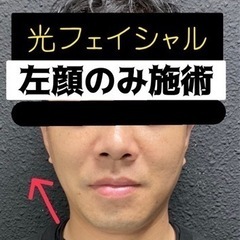 ❤️全身脱毛500円❤️