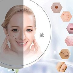 【新品】シミ取り　レーザーペン　ホクロ　イボ　ソバカス　美容　ピーリング　スキンケア　の画像