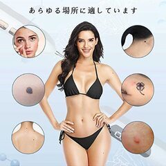 【新品】シミ取り　レーザーペン　ホクロ　イボ　ソバカス　美容　ピーリング　スキンケア　の画像