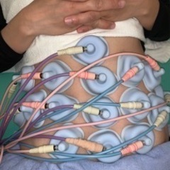 ダイエット・高周波治療器による❗️❗️ - その他