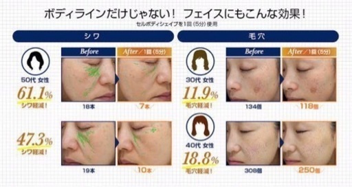 業務用エステ用品⑦【ピンク】TBC防水セルボディシェイプ美顔器EMS