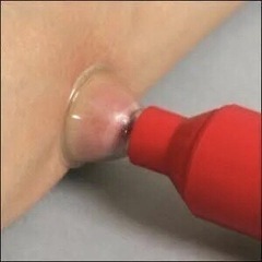 売り切れました、ありがとうございました‼️ 新品未使用‼️ 　Venimex ANTI-VENINの画像