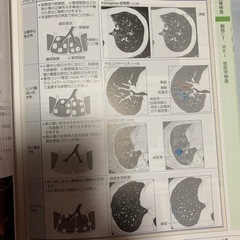 呼吸器　病気が見える　看護　医療の画像
