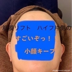 ２６日　ハイフ　シミケア