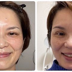 【表情筋トレ】若返り・笑顔美人・シワたるみ解消。お顔を動かしてハート型フェイスへ♡の画像