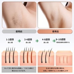 【新品】IPL光美容器 全身脱毛器 無痛冷感サファイア脱毛器 男女兼用 レディース メンズ vio 冷却機能  顔 ワキ ヒゲ ビキニライン 自宅脱毛（5）の画像