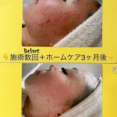 ★無料カウンセリング★ エンビロン正規取扱店の画像