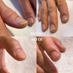 爪周りのゴチゴチ、そのままにしていませんか？
