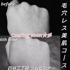 四谷三丁目徒歩２分プライベートサロン 手の甲シミ消し モニター様...