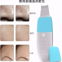 ピーリング美顔器の画像