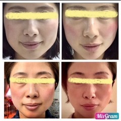 表情筋エステ短期セミナー募集中の画像