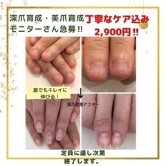 美爪育成★反り爪・深爪・爪補強　モニター様急募❗️