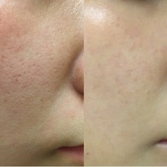 【最短3日で導入！サロン開業サポート付き】話題のエステメニューの手技と導入の画像