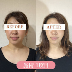 未経験から始める速攻小顔12Dハイフ専門店セラピスト募集！の画像