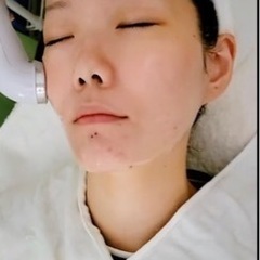 １ヶ月スキンケアモニター募集中　3850円〜　無料超音波エステ4...