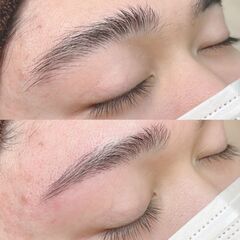 糸脱毛の練習モニター募集 - 美容