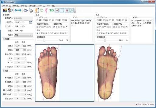 中古現行品　足型計測器　足圧測定器　参照：FootNavi   RealFoot  トゥルーフィート
