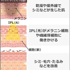 【初回レンタル無料】家庭用美顔器 / 脱毛器 ケノン レンタル - 燕市