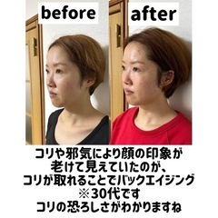 【鍼処NANGAKUDO-南学堂-】巷の美容鍼とは一味違う、圧倒的な効果が人気のルート鬼美容鍼 − 兵庫県