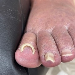 トラブルのお爪の方募集してます！