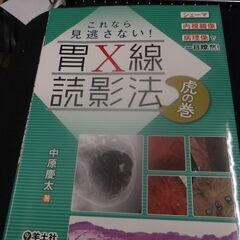 シェーマ+内視鏡像+病理像で一目瞭然! これなら見逃さない! 胃...
