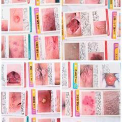 皮膚の見方ナビガードの画像