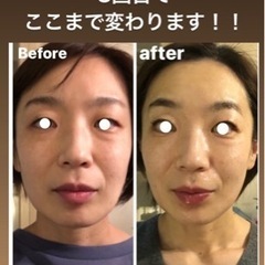 ☆バービーの肌を変えた話題のダーマペン【モニター様３名募集】 - 地元のお店