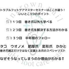 巻き爪補正スクールの画像