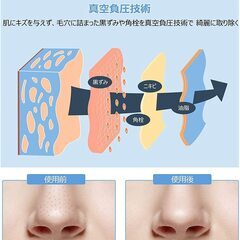【即日・手渡し可】　新品未開封 毛穴吸引器 毛穴ケア ニキビ吸引 美顔器 毛穴クリーナー 黒ずみ取り 毛穴吸引 フェイスケア 【20倍毛穴画面拡大 500万画素 専用アプリ付き】 3段階吸引力 6種類吸引ヘッド USB充電式の画像