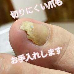 トラブルフットケアマスターセミナーの画像