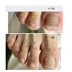 お悩み爪のお手入れセミナーの画像