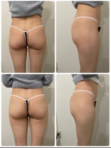 中古　売り切り価格☆ 次世代EMS エステサロン